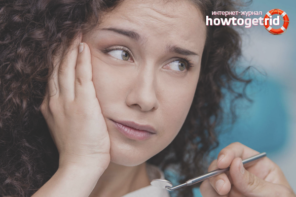 How to get rid of flux