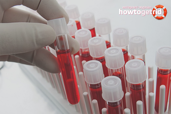 How to lower adrenaline