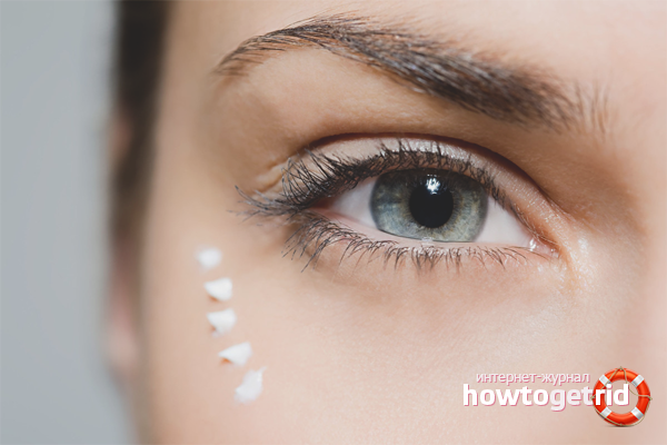How to get rid of crow's feet around the eyes