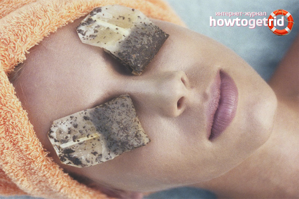 How to get rid of eye redness at home