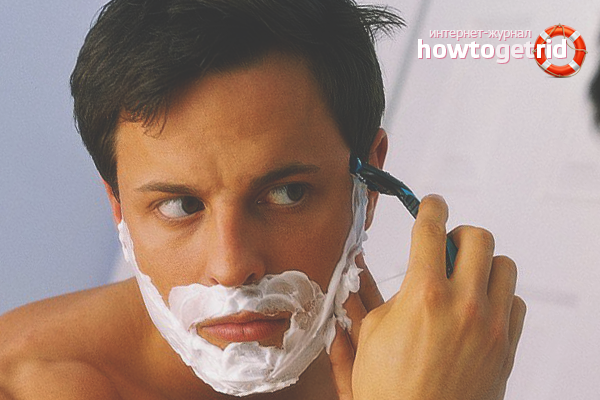 How to get rid of acne after shaving