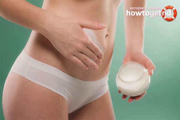 How to get rid of stretch marks