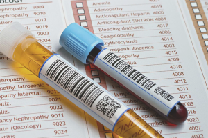 How to lower uric acid in the blood