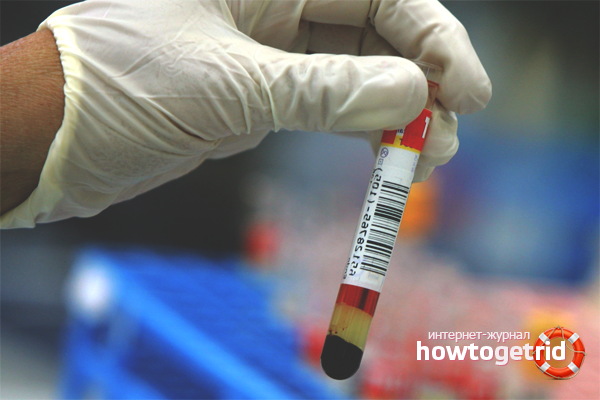 How to lower uric acid in the blood with folk remedies