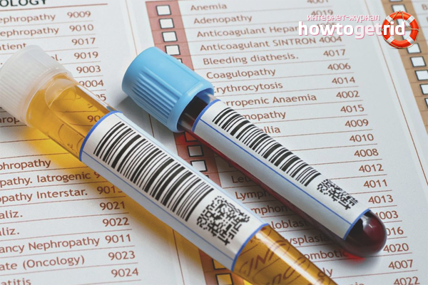 How to lower uric acid in the blood