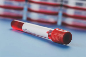 How to increase hemoglobin during pregnancy