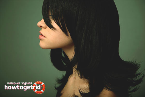 How to get rid of black hair color