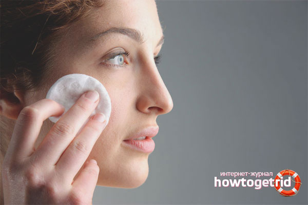 How to get rid of black dots on your face