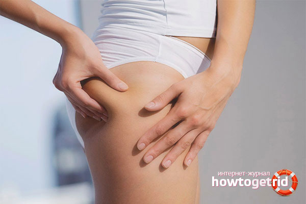 How to get rid of breeches on hips