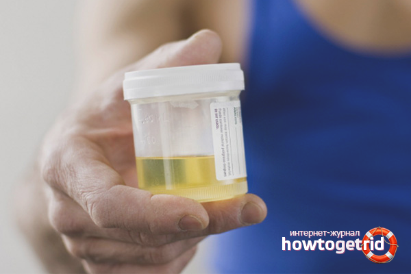 How to collect urine using a plastic bag