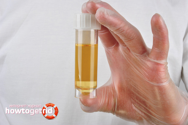 How to collect urine in a newborn girl