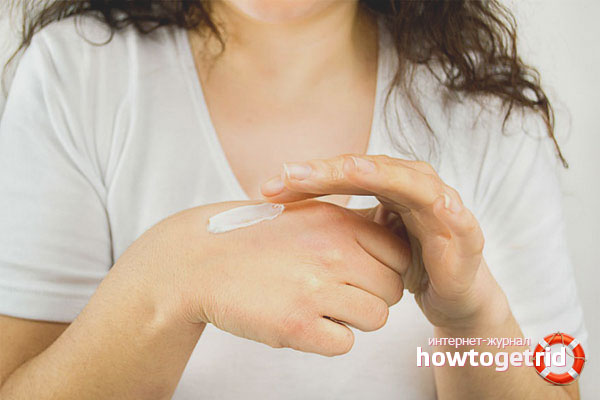 First aid for urticaria