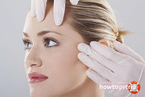 Elimination of facial wrinkles in salon conditions