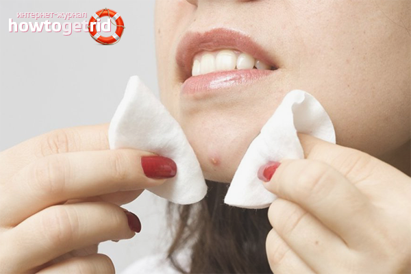 How to quickly get rid of a boil