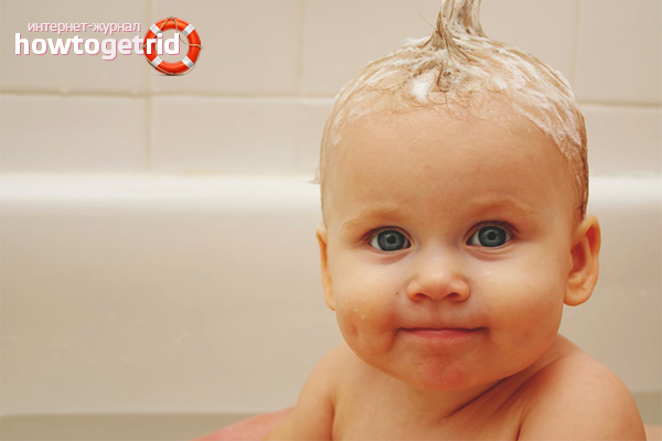 How to get rid of crusts on the baby's head