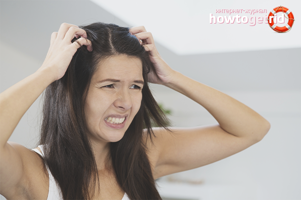 How to get rid of itchy scalp