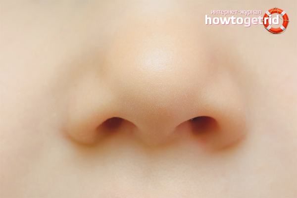 How to treat sore nose at home