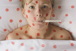 How to treat chickenpox in adults