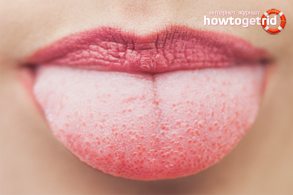 Unusual color plaque