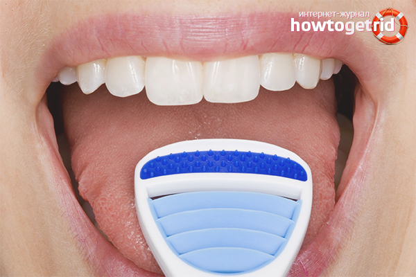 Oral Hygiene Devices