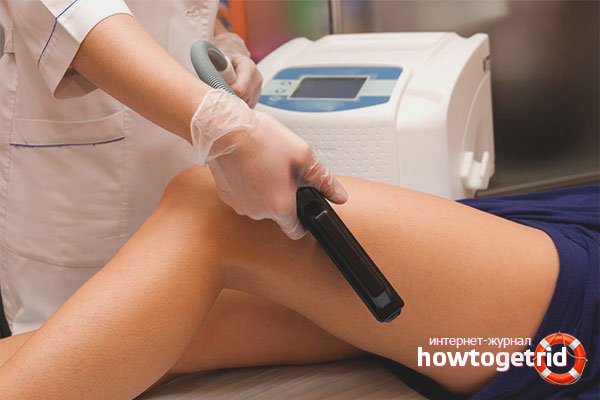 We remove stretch marks on the legs in the beauty salon