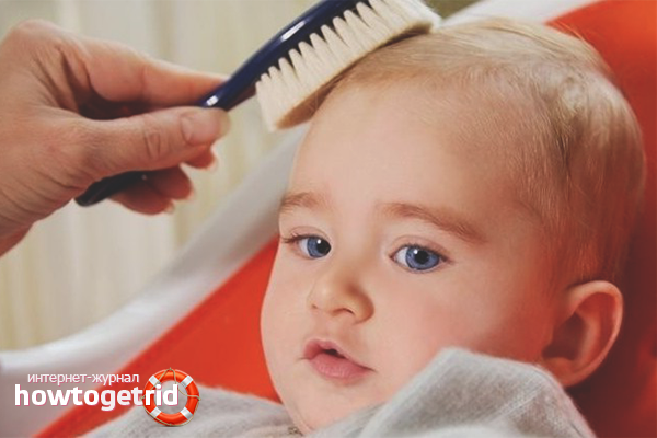 Removing crusts on the head with a comb