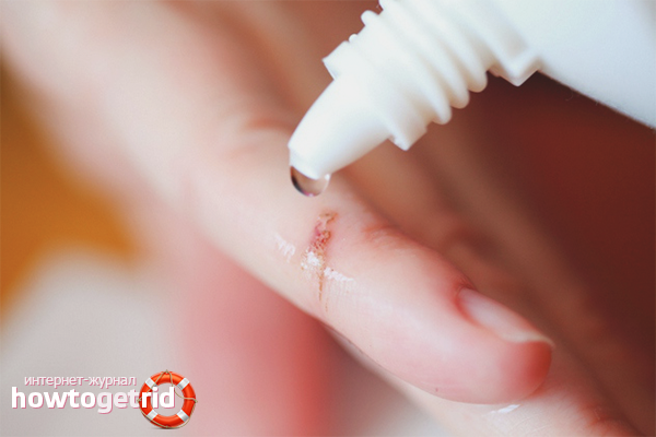 Antiseptics for cut disinfection