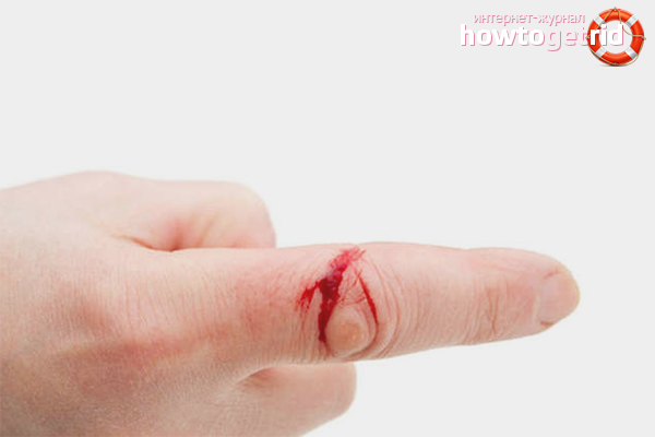 How to stop blood when cut