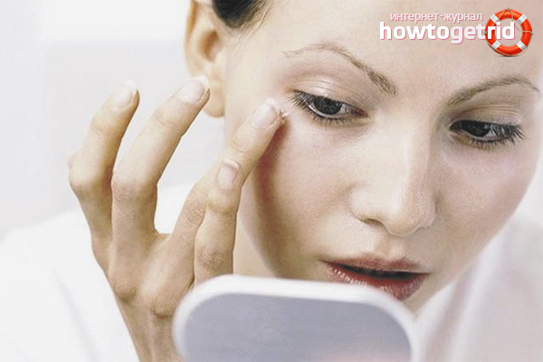 Effective ways to eliminate swelling under the eyes