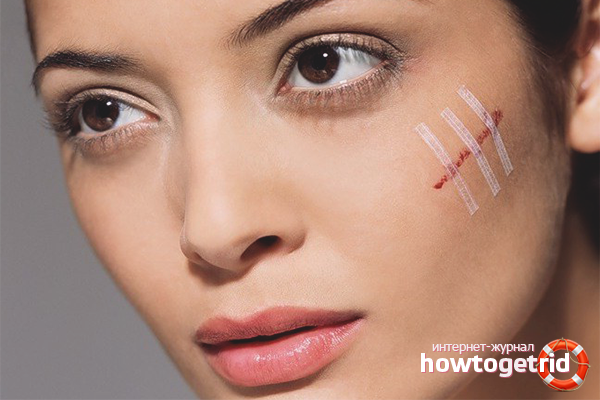 How to quickly get rid of scratches by folk methods