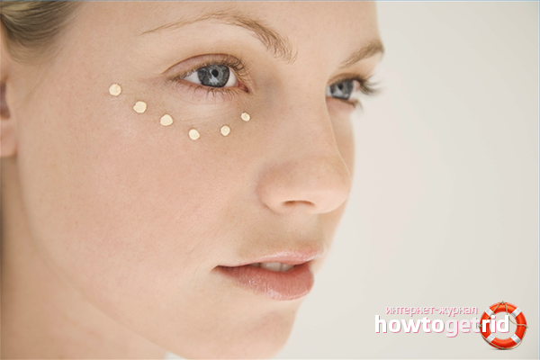 How to get rid of edema under the eyes