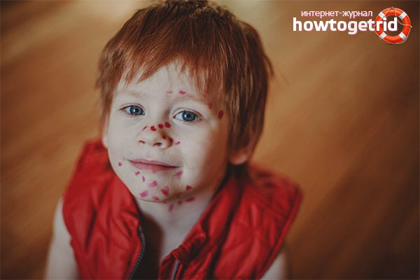 How to wash fucorcin from the skin