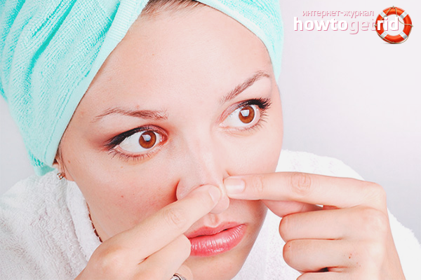 How to remove black dots on the nose