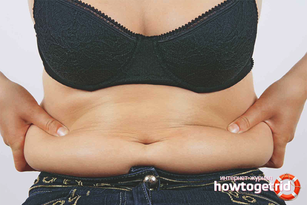 How to remove a hanging belly