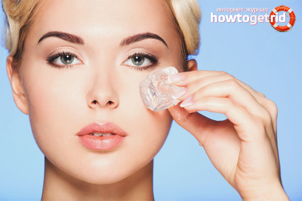 Cosmetic ice from edema under the eyes
