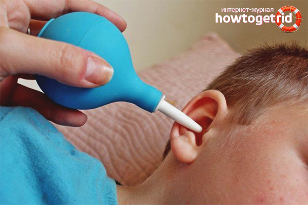 How to treat otitis media in a child at home