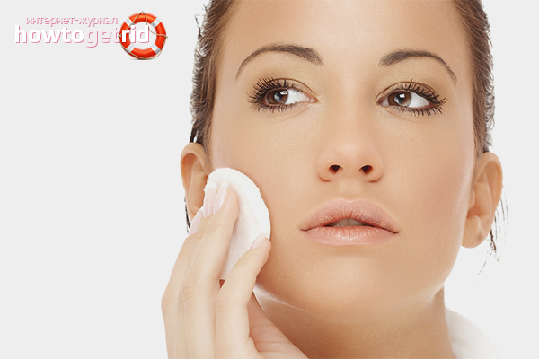 How to get rid of acne marks