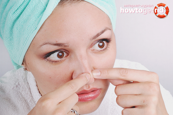 How to get rid of blackheads on the nose