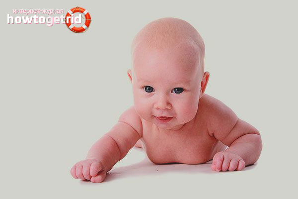 Why the child does not hold his head