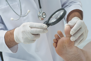 How to treat foot fungus