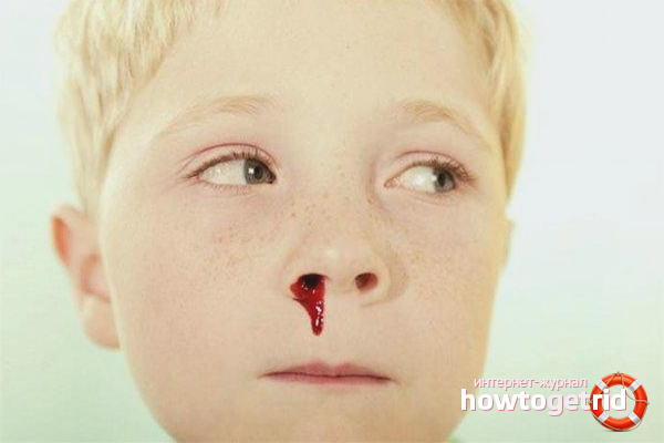Blood from the nose of a child