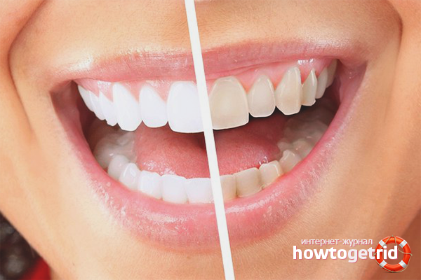 How to get rid of plaque on your teeth