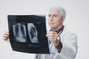 How to treat pneumonia