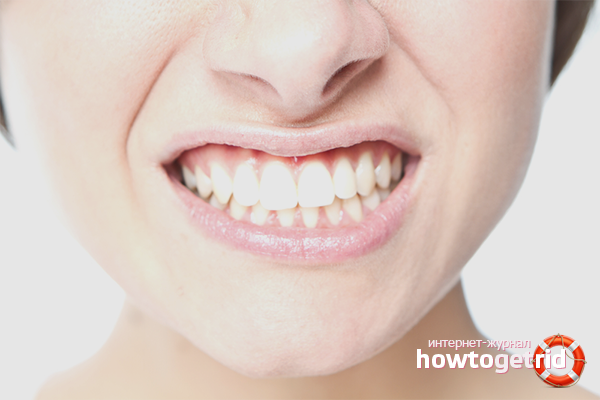 How to treat gum disease