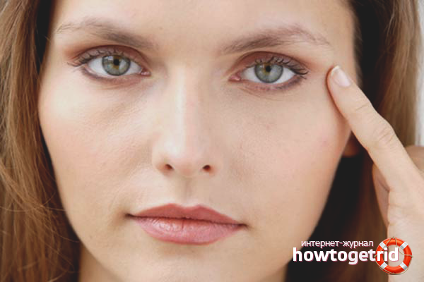 How to remove veins under the eyes
