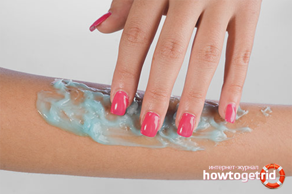 Préparations pour une brûlure avec de l'eau bouillante