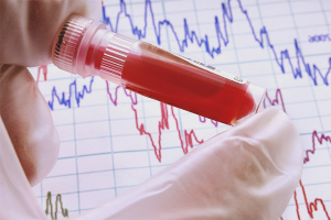 How to lower bilirubin in the blood