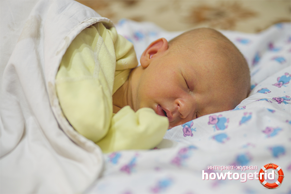 Sorten von Gelbsucht