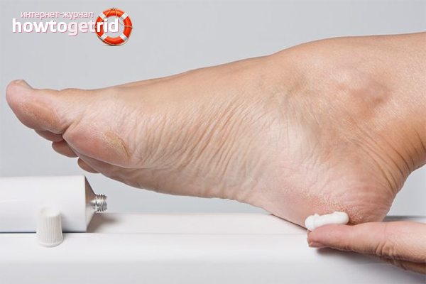 Préparations pharmaceutiques pour éperons au talon