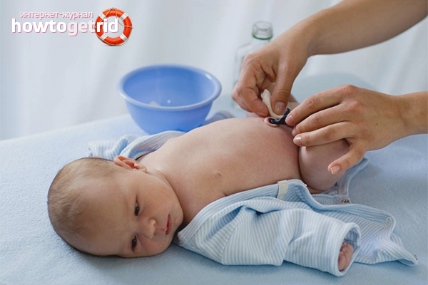 How to handle a navel for a newborn